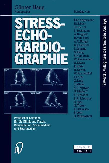 Cover: 9783642638190 | Streß-echokardiographie | Guenter Haug | Taschenbuch | Paperback