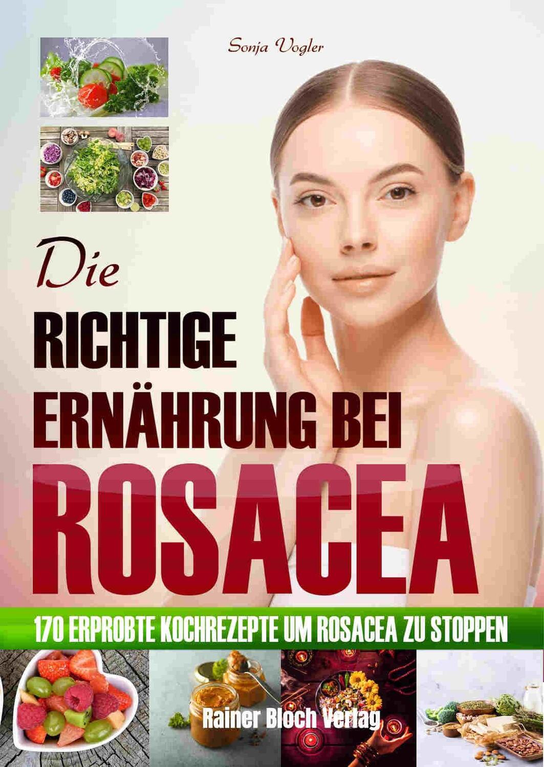 Cover: 9783942179584 | Die richtige Ernährung bei Rosacea | Sonja Vogler | Taschenbuch | 2020