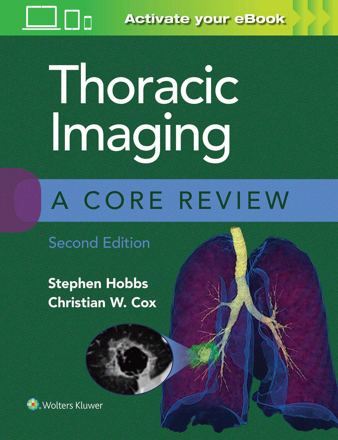 Cover: 9781975126223 | Thoracic Imaging: A Core Review | Stephen Hobbs (u. a.) | Taschenbuch