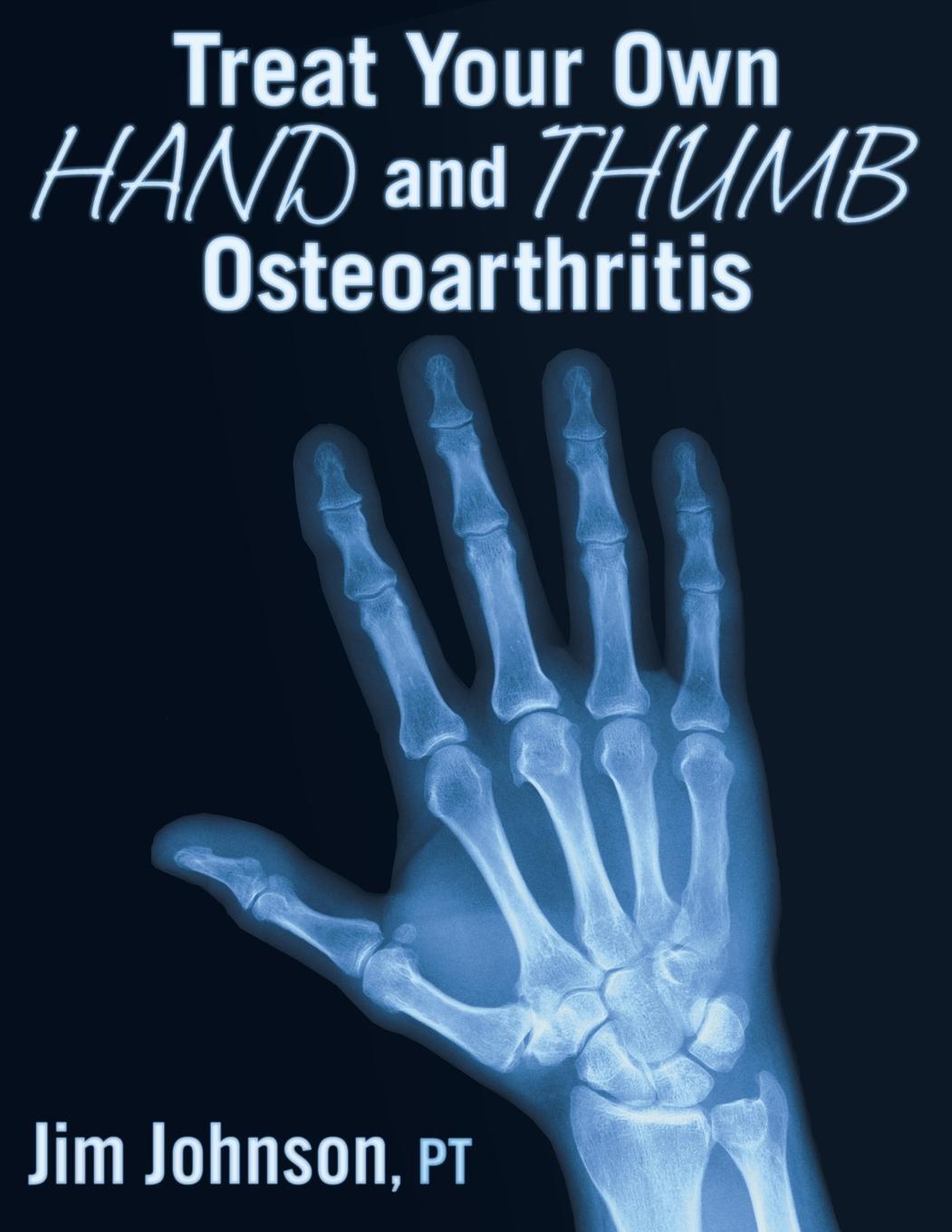 Cover: 9781642376470 | Treat Your Own Hand and Thumb Osteoarthritis | Jim Johnson | Buch