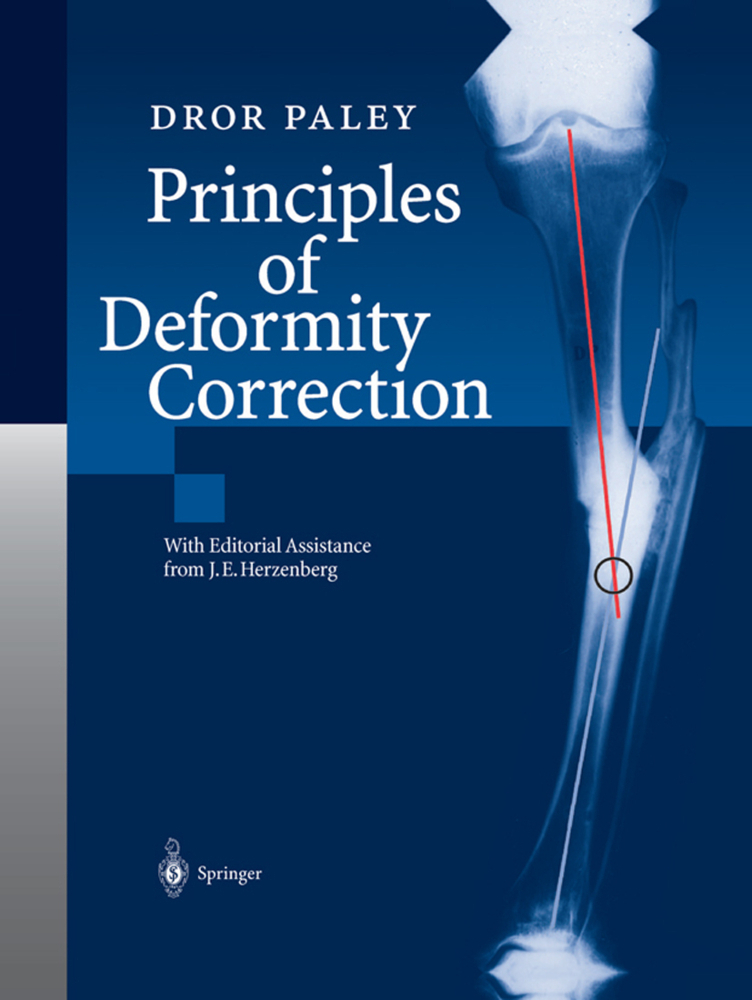 Cover: 9783642639531 | Principles of Deformity Correction, 2 Pts. | Dror Paley | Taschenbuch