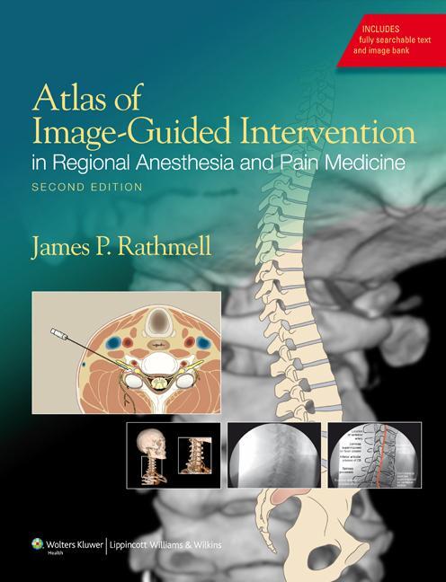 Cover: 9781608317042 | Atlas of Image-Guided Intervention in Regional Anesthesia and Pain...
