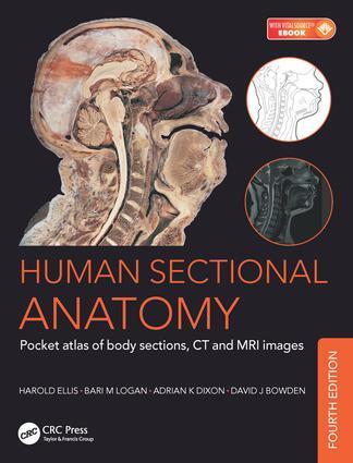Cover: 9781498708548 | Human Sectional Anatomy | Harold Ellis (u. a.) | Taschenbuch | 2017