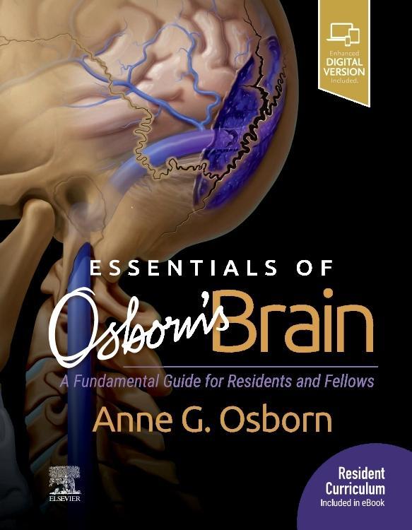 Cover: 9780323713207 | Essentials of Osborn's Brain | Anne G Osborn | Buch | Gebunden | 2019