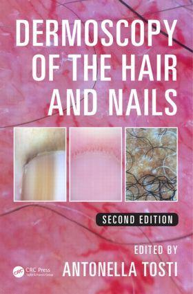 Cover: 9781482234053 | Dermoscopy of the Hair and Nails | Antonella Tosti | Buch | Englisch