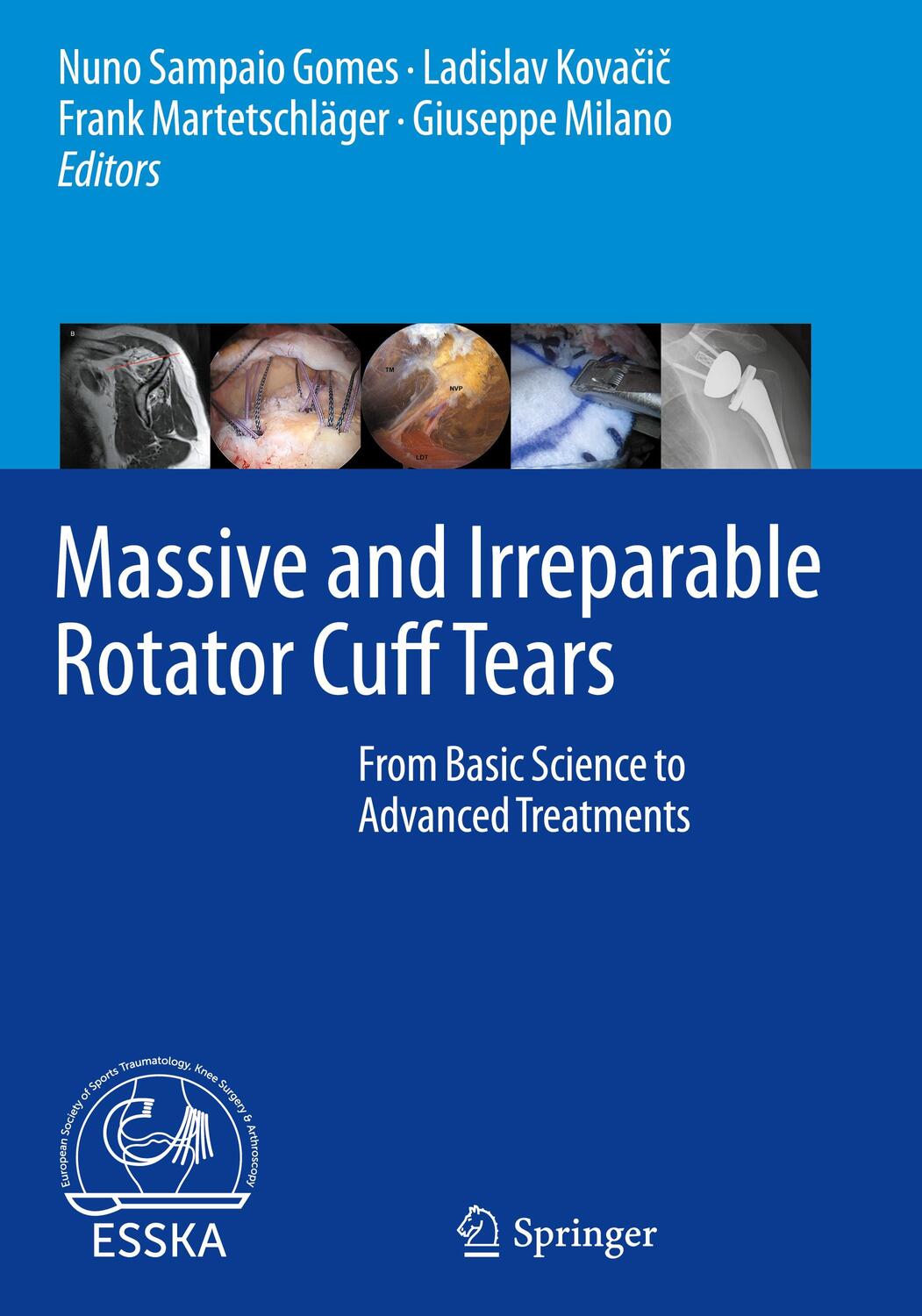 Cover: 9783662611616 | Massive and Irreparable Rotator Cuff Tears | Gomes (u. a.) | Buch