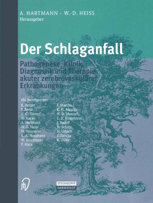 Cover: 9783642633164 | Der Schlaganfall | A. Hartmann (u. a.) | Taschenbuch | Steinkopff