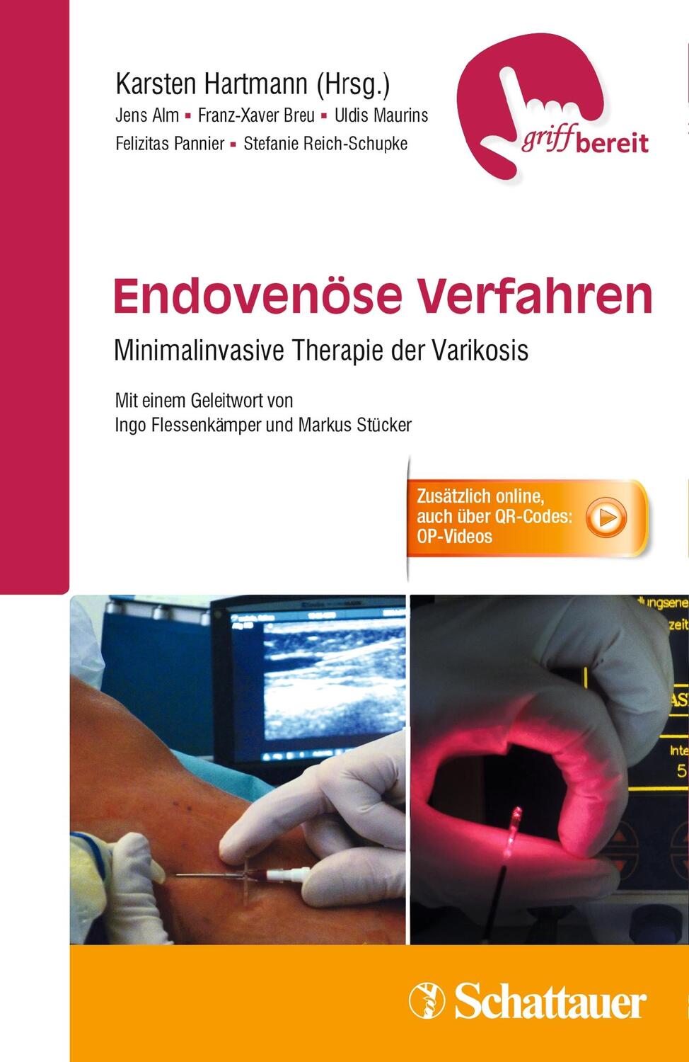 Cover: 9783794530878 | Endovenöse Verfahren | Jens Alm (u. a.) | Taschenbuch | Deutsch | 2015