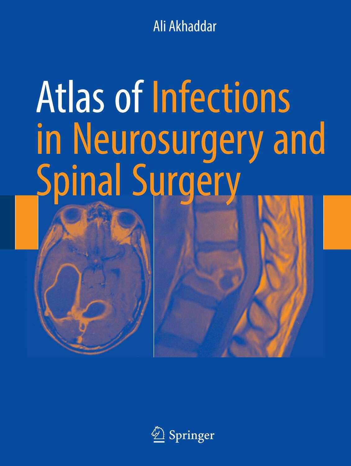 Cover: 9783319600857 | Atlas of Infections in Neurosurgery and Spinal Surgery | Ali Akhaddar