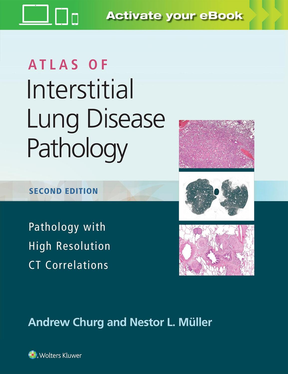 Cover: 9781975124670 | Atlas of Interstitial Lung Disease Pathology | Andrew Churg (u. a.)