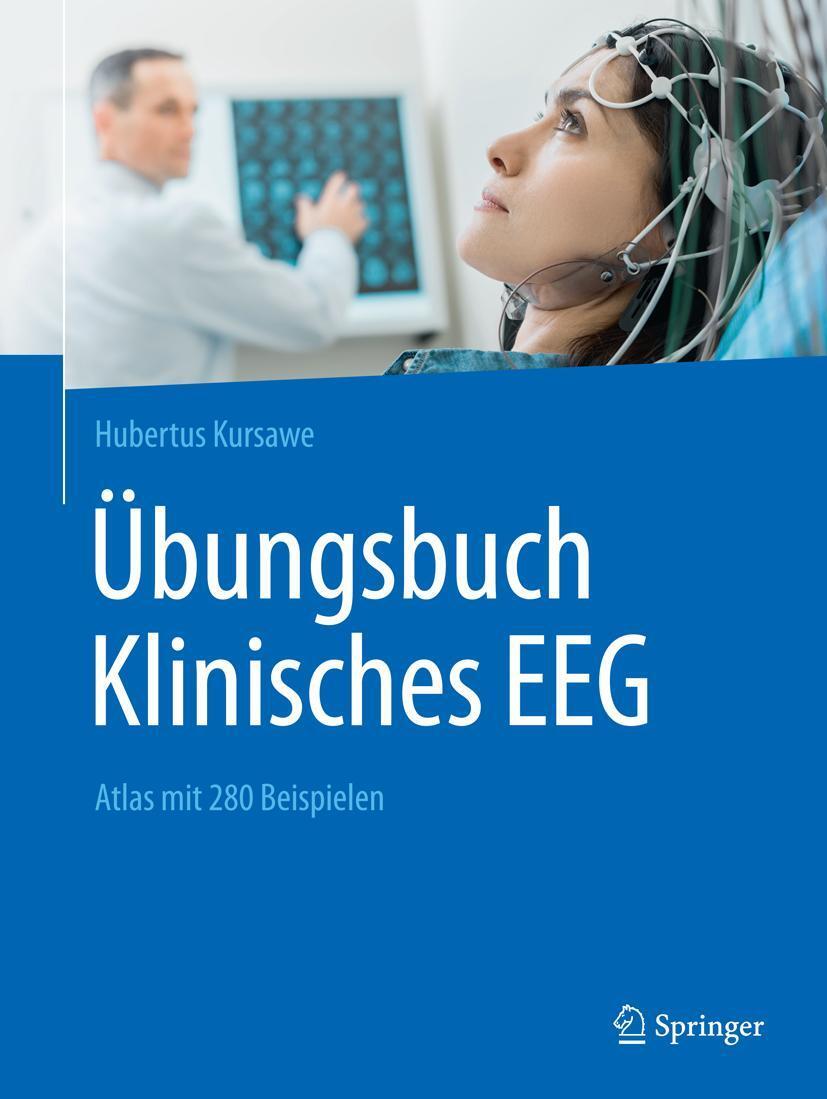 Cover: 9783662567555 | Übungsbuch Klinisches EEG | Atlas mit 280 Beispielen | Kursawe | Buch