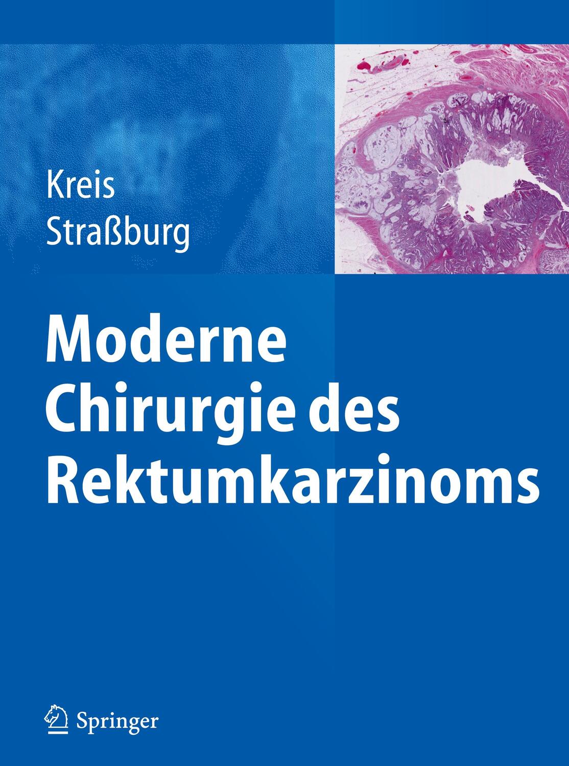 Cover: 9783642403897 | Moderne Chirurgie des Rektumkarzinoms | Joachim Straßburg (u. a.) | XI