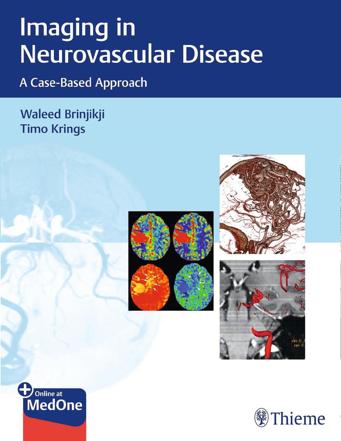 Cover: 9781684200535 | Imaging in Neurovascular Disease | A Case-Based Approach | Taschenbuch