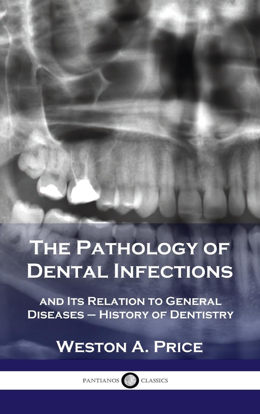 Cover: 9781789873672 | Pathology of Dental Infections | Weston A. Price | Buch | Englisch