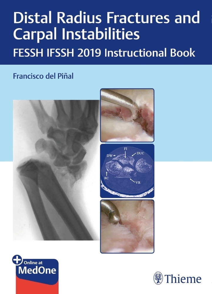 Cover: 9783132423794 | Distal Radius Fractures and Carpal Instabilities | Francisco Pinal
