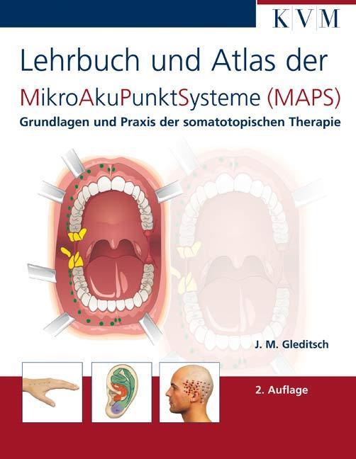 Cover: 9783932119521 | Mikro-Aku-Punkt-Systeme | Jochen M. Gleditsch | Taschenbuch | Deutsch
