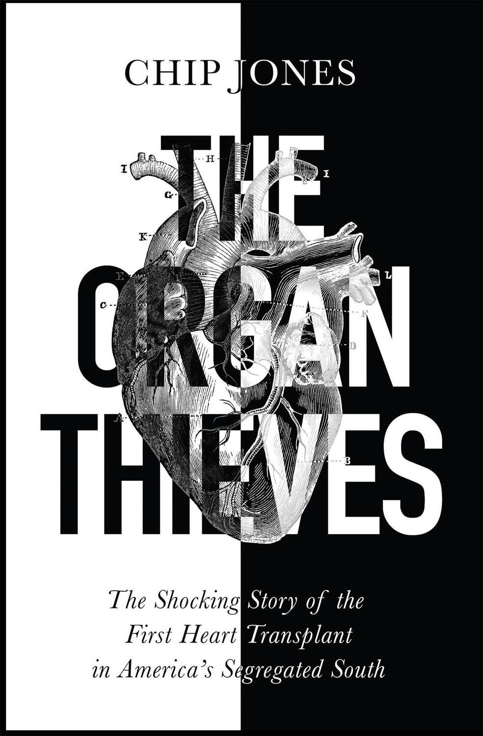 Cover: 9781529400625 | The Organ Thieves | Chip Jones | Taschenbuch | Kartoniert / Broschiert