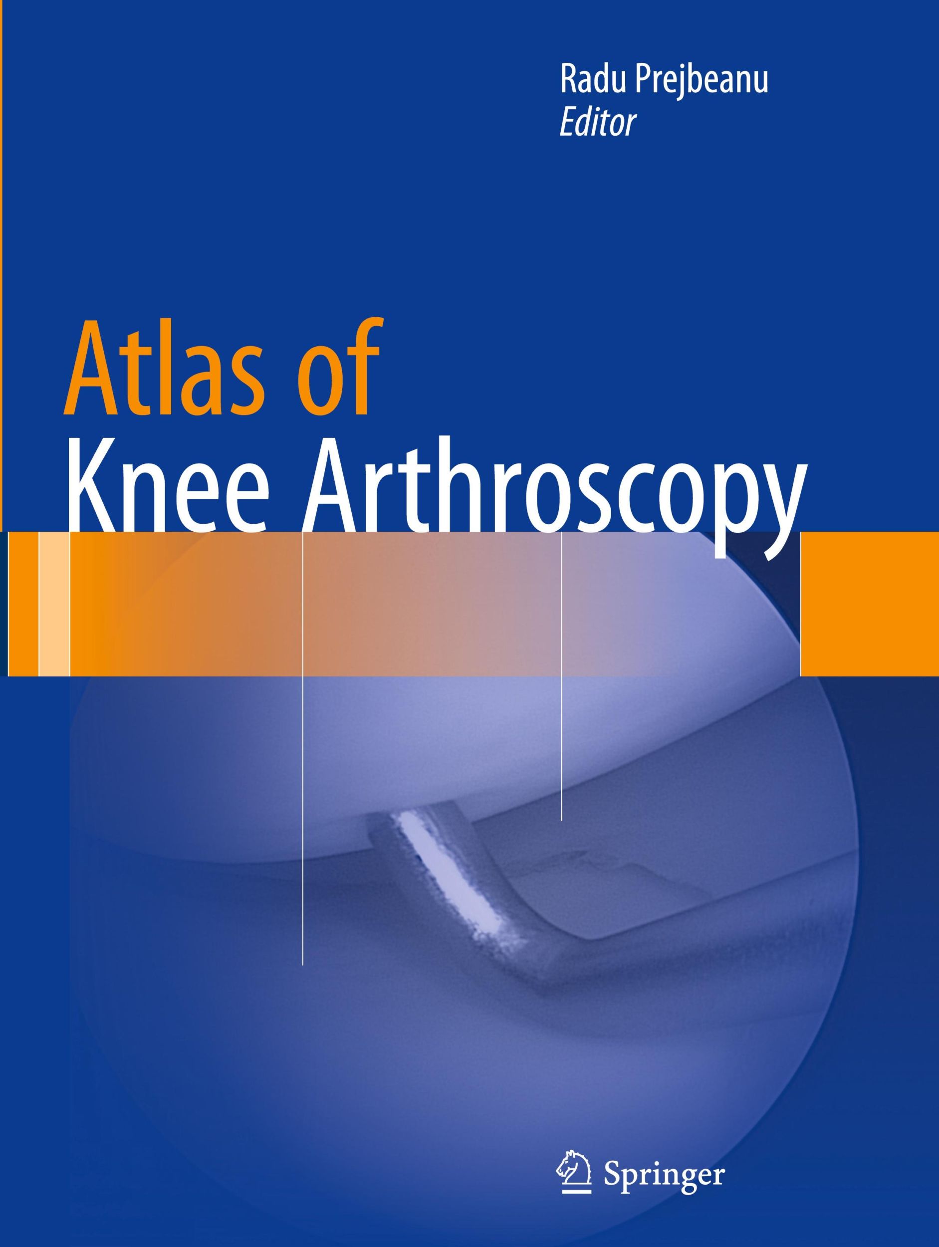 Cover: 9781447171096 | Atlas of Knee Arthroscopy | Radu Prejbeanu | Taschenbuch | Paperback