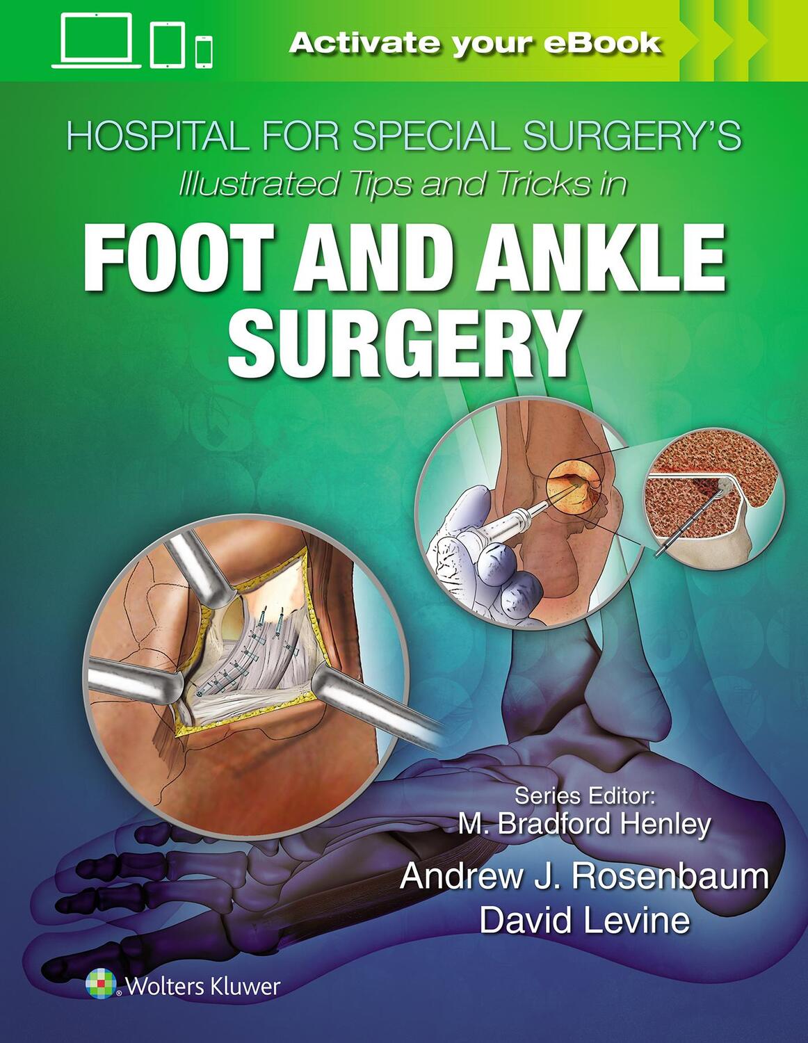 Cover: 9781496365101 | Hospital for Special Surgery's Illustrated Tips and Tricks in Foot...