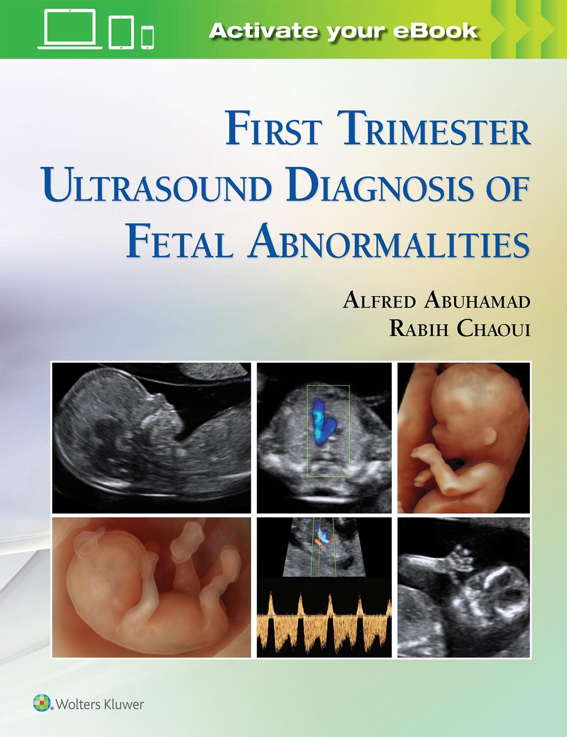 Cover: 9781451193725 | First Trimester Ultrasound Diagnosis of Fetal Abnormalities | Buch