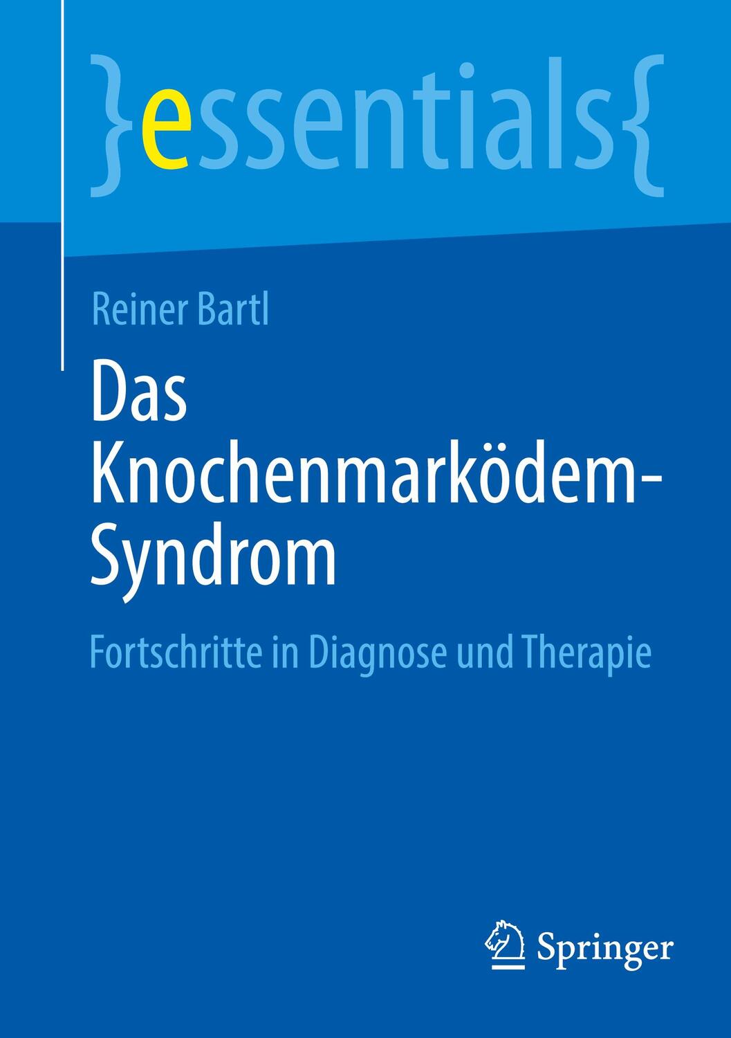 Cover: 9783662690130 | Das Knochenmarködem-Syndrom | Fortschritte in Diagnose und Therapie