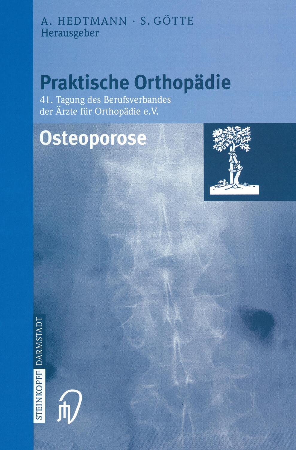 Cover: 9783798513006 | Osteoporose | Siegfried Götte (u. a.) | Taschenbuch | Paperback | x