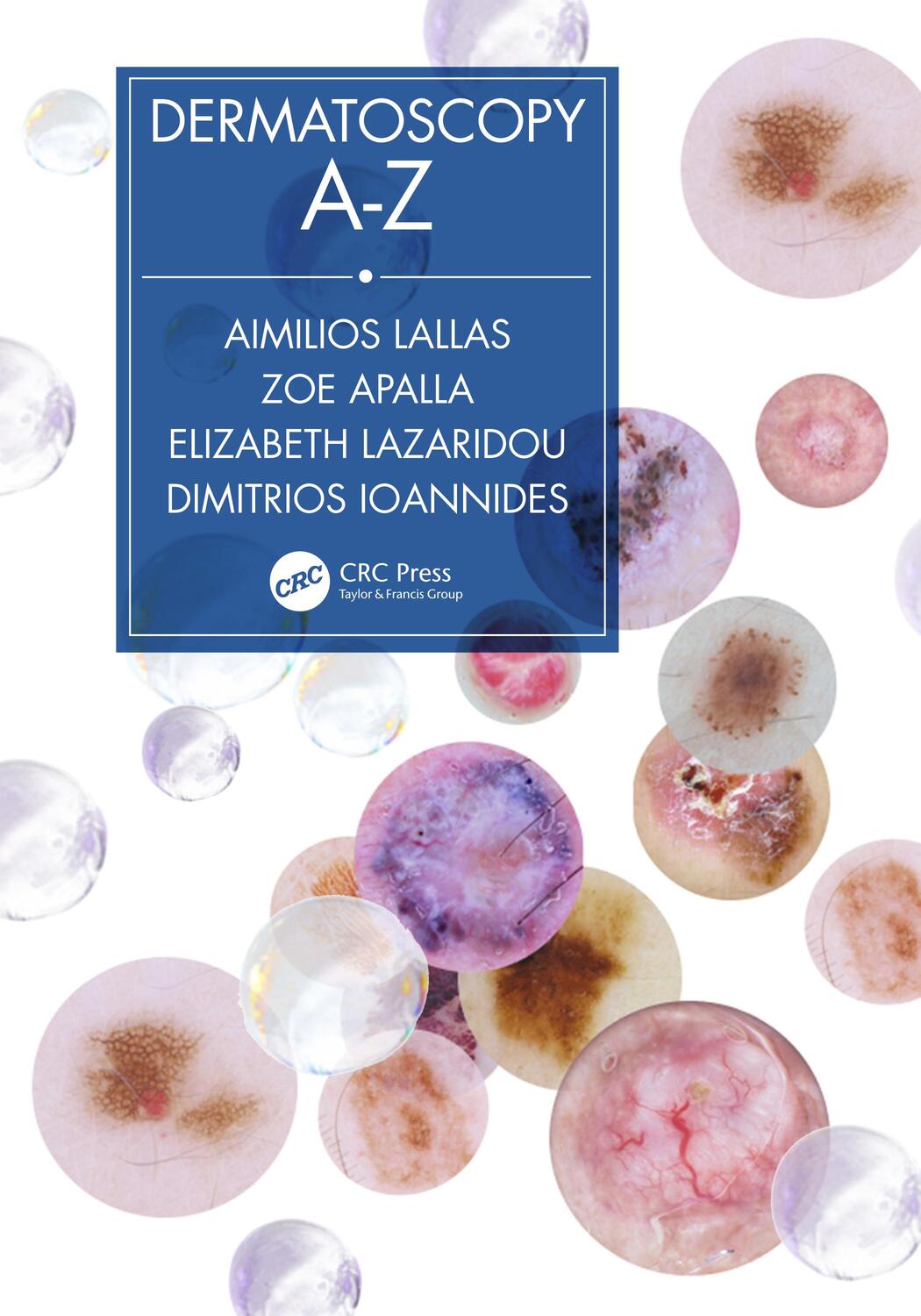 Cover: 9780367197810 | Dermatoscopy A-Z | Aimilios Lallas (u. a.) | Taschenbuch | Englisch