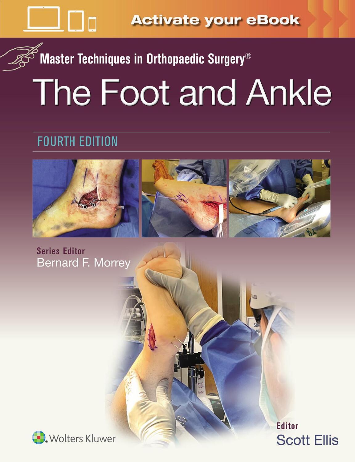 Cover: 9781975199418 | Master Techniques in Orthopaedic Surgery: The Foot and Ankle: Print...