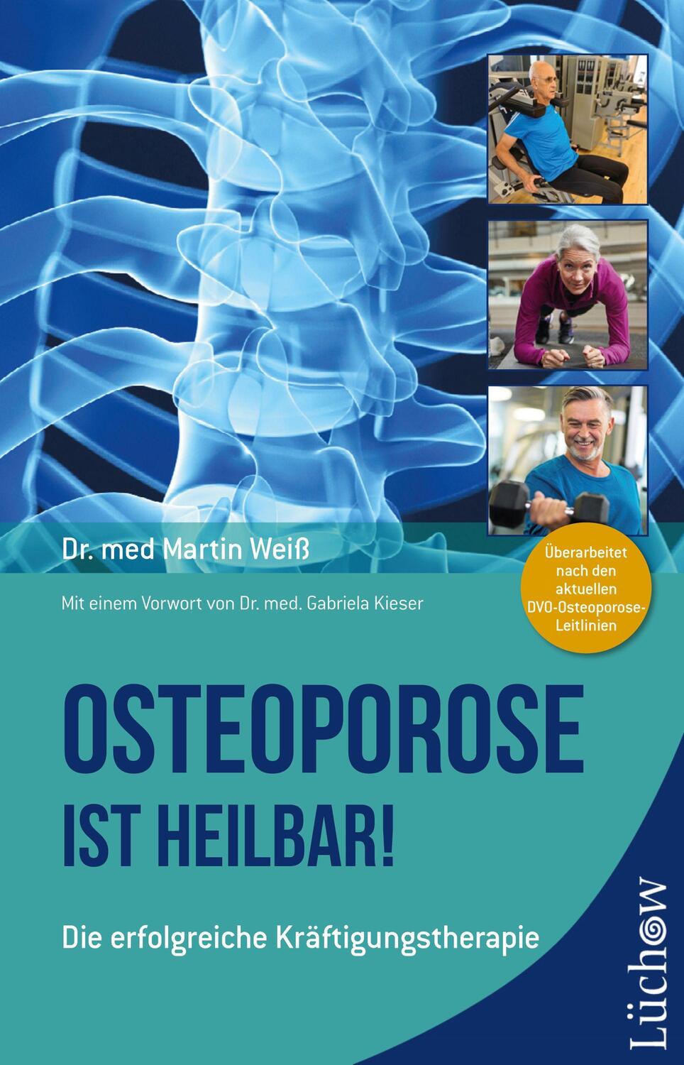 Cover: 9783958834996 | Osteoporose ist heilbar! | Die erfolgreiche Kräftigungstherapie | Weiß