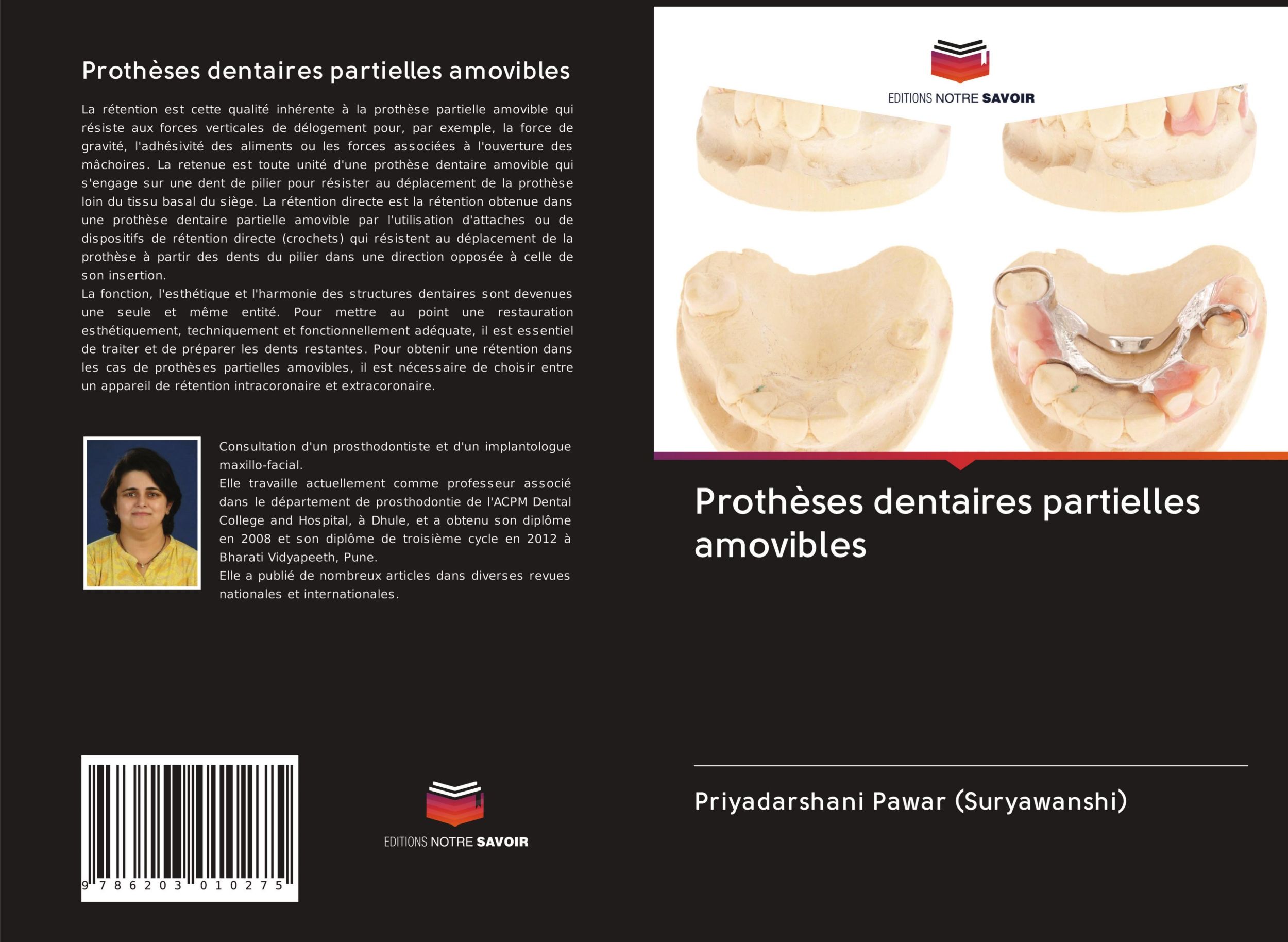 Cover: 9786203010275 | Prothèses dentaires partielles amovibles | Priyadarshani Pawar | Buch