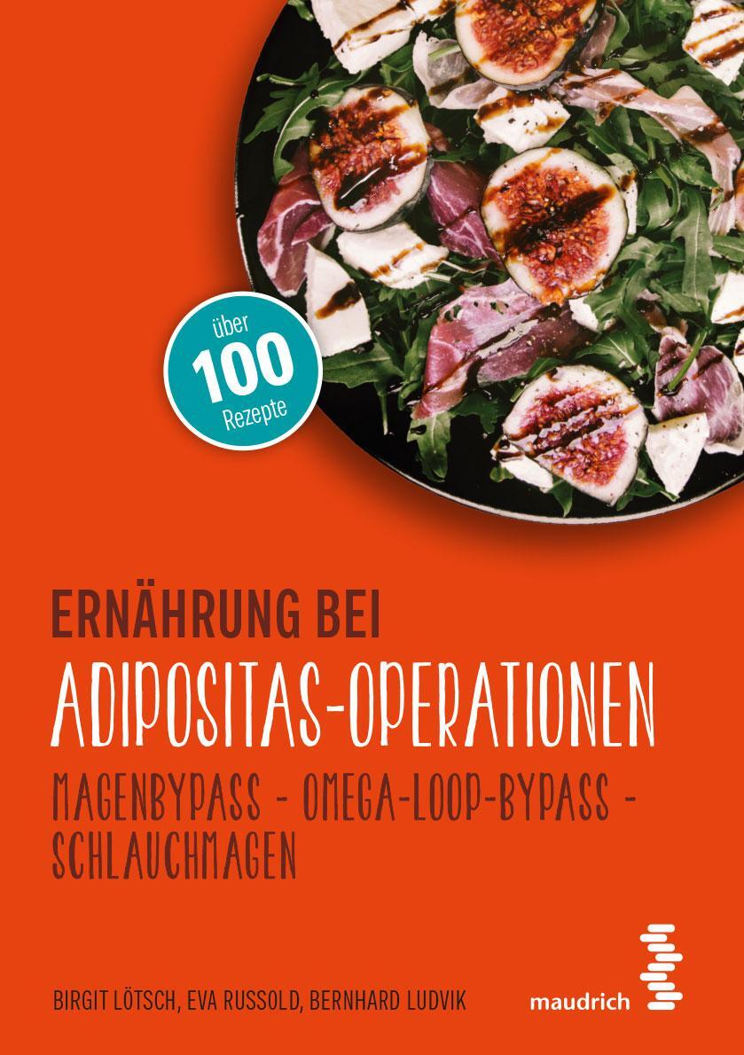 Cover: 9783990021293 | Ernährung bei Adipositas-Operationen | Birgit Lötsch (u. a.) | Buch