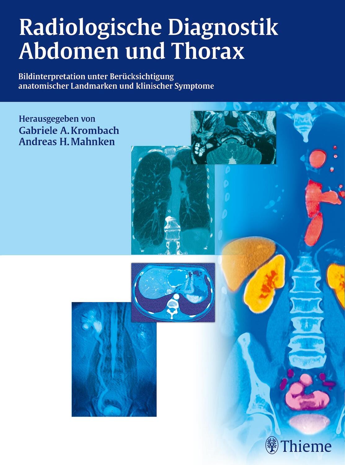 Cover: 9783131729217 | Radiologische Diagnostik Abdomen und Thorax | Krombach (u. a.) | Buch