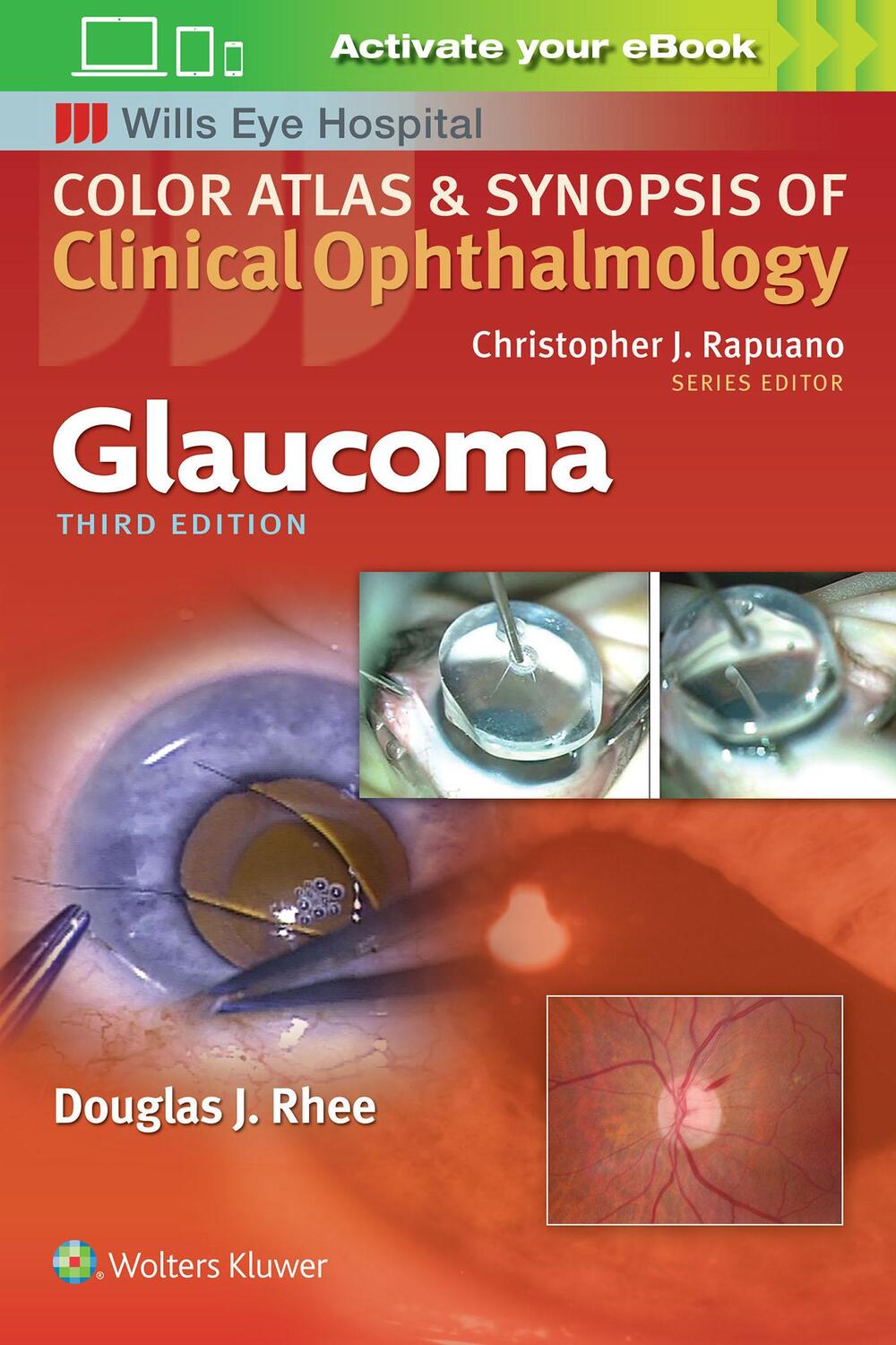 Cover: 9781496363480 | Glaucoma (Color Atlas and Synopsis of Clinical Ophthalmology) | Rhee