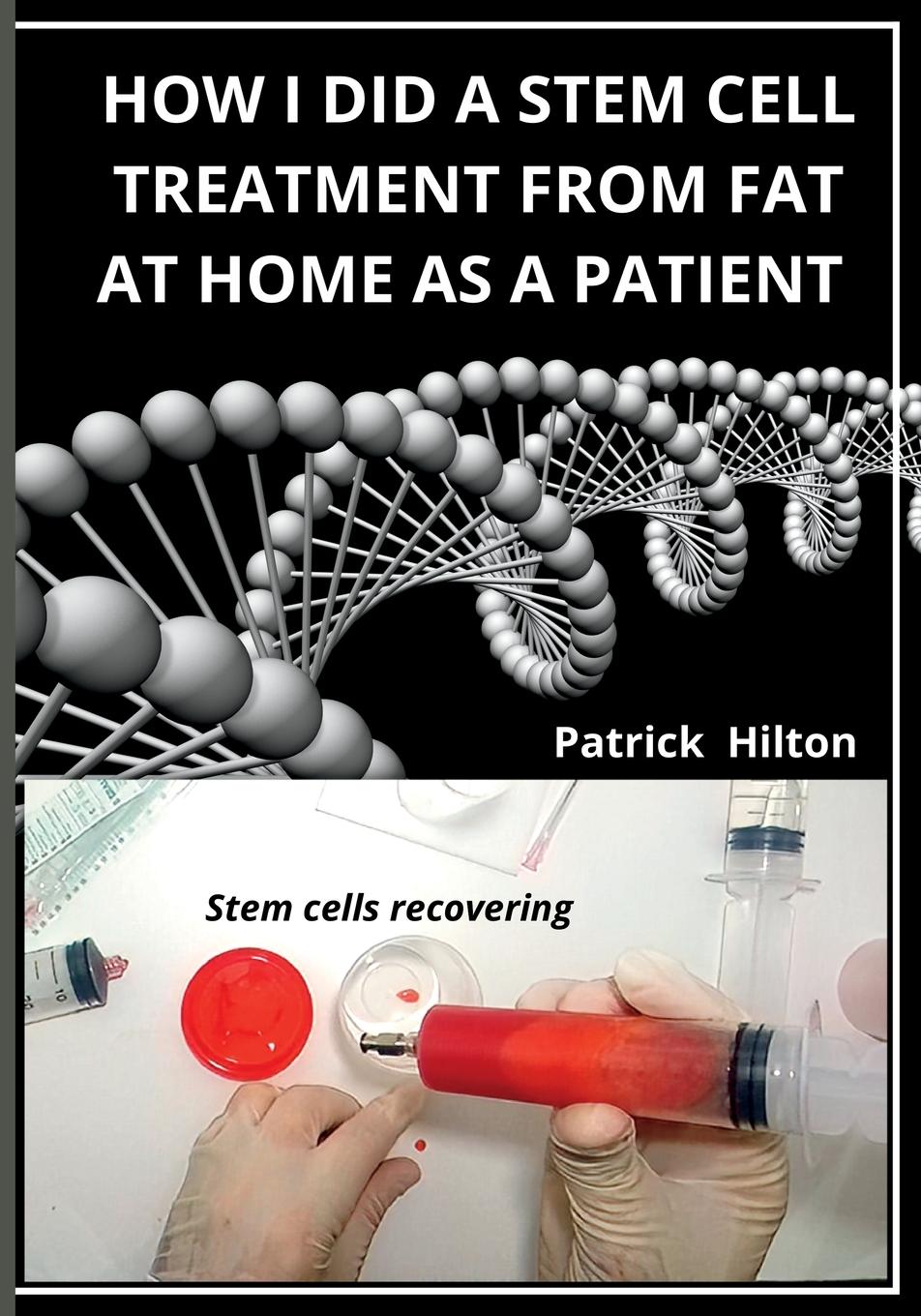 Cover: 9789730371581 | How I Did a Stem Cell Treatment From Fat at Home as a Patient | Hilton