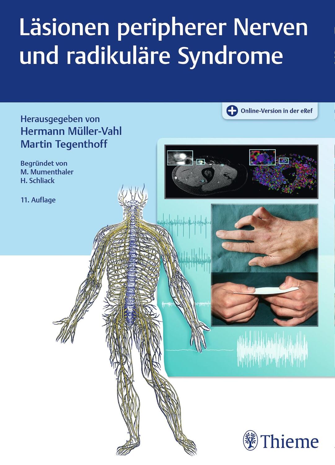 Cover: 9783132416147 | Läsionen peripherer Nerven und radikuläre Syndrome | Bundle | 1 Buch