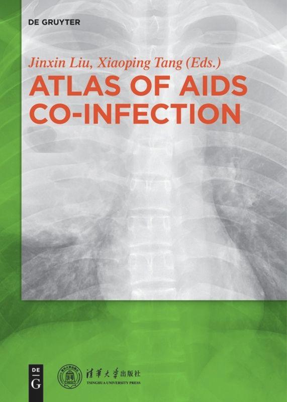 Cover: 9783110579895 | Atlas of AIDS Co-infection | Tang Xiaoping (u. a.) | Taschenbuch