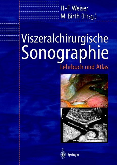 Cover: 9783642629587 | Viszeralchirurgische Sonographie | Lehrbuch und Atlas | Weiser (u. a.)