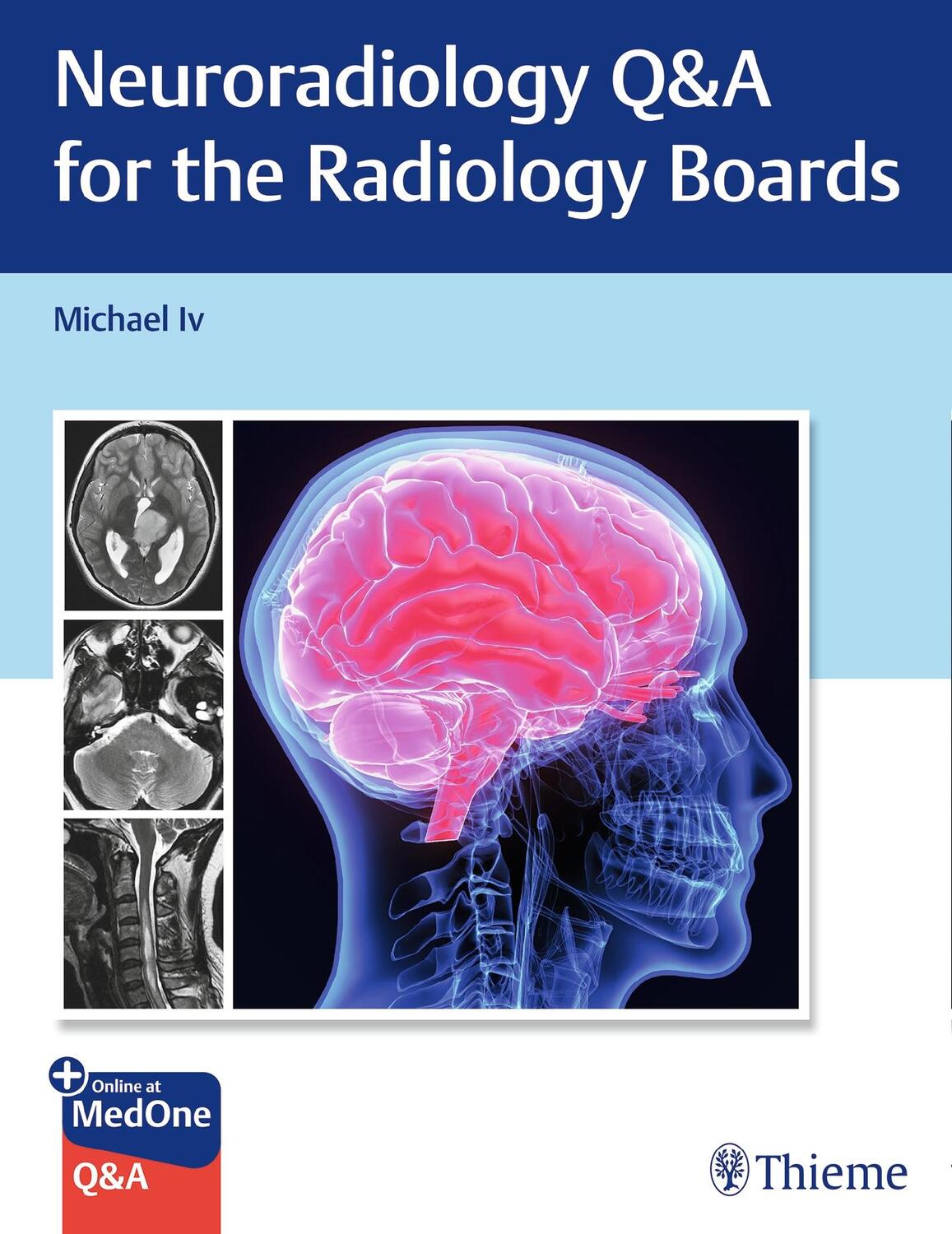 Cover: 9781684205592 | Neuroradiology Q&A for the Radiology Boards | Michael Iv | Taschenbuch
