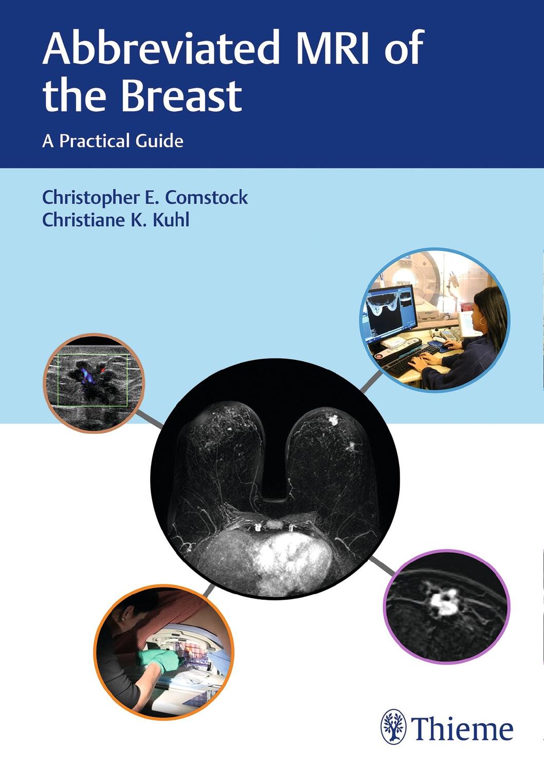 Cover: 9781626231931 | Abbreviated MRI of the Breast: A Practical Guide | Comstock (u. a.)