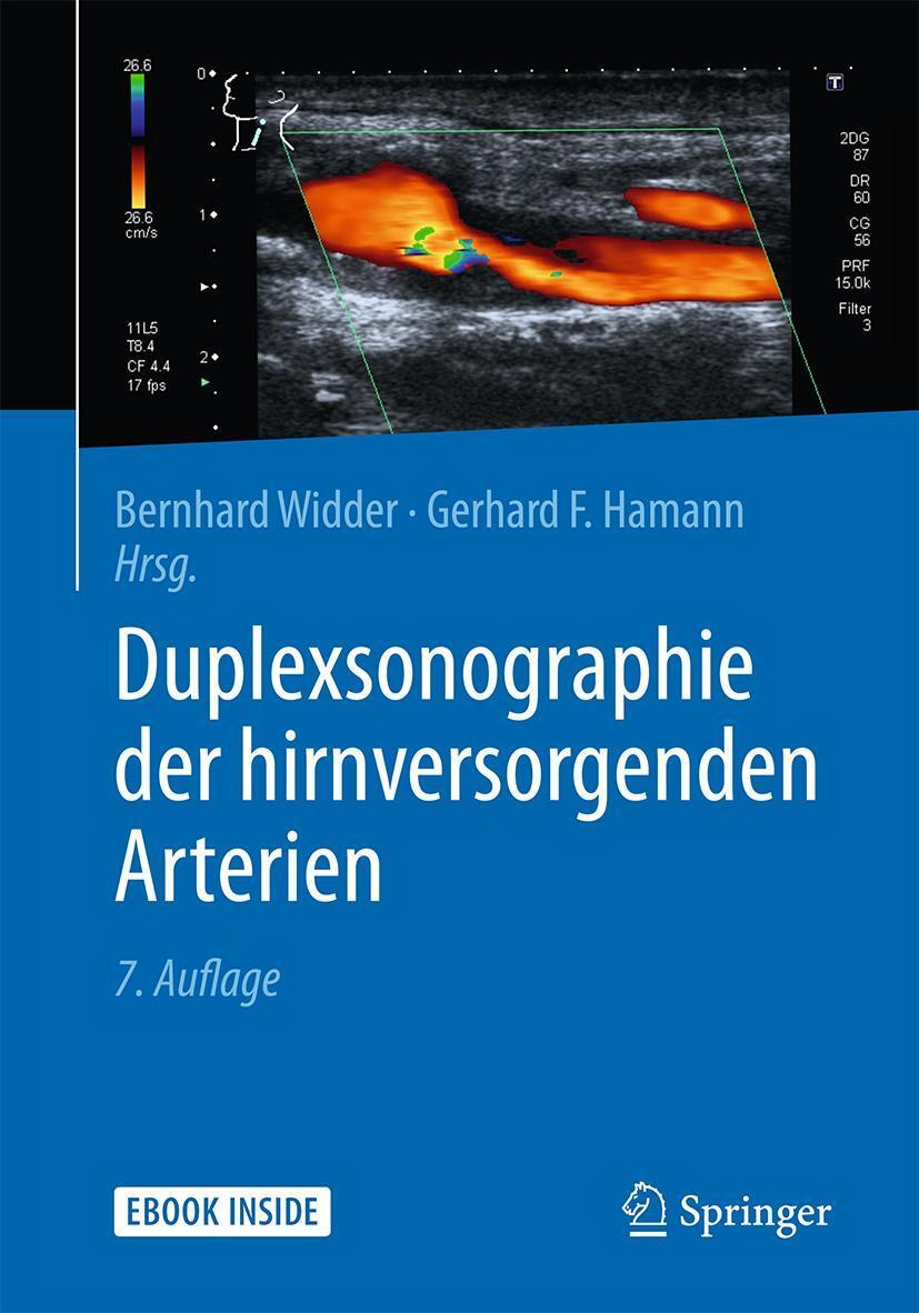 Cover: 9783642298110 | Duplexsonographie der hirnversorgenden Arterien | Widder (u. a.)