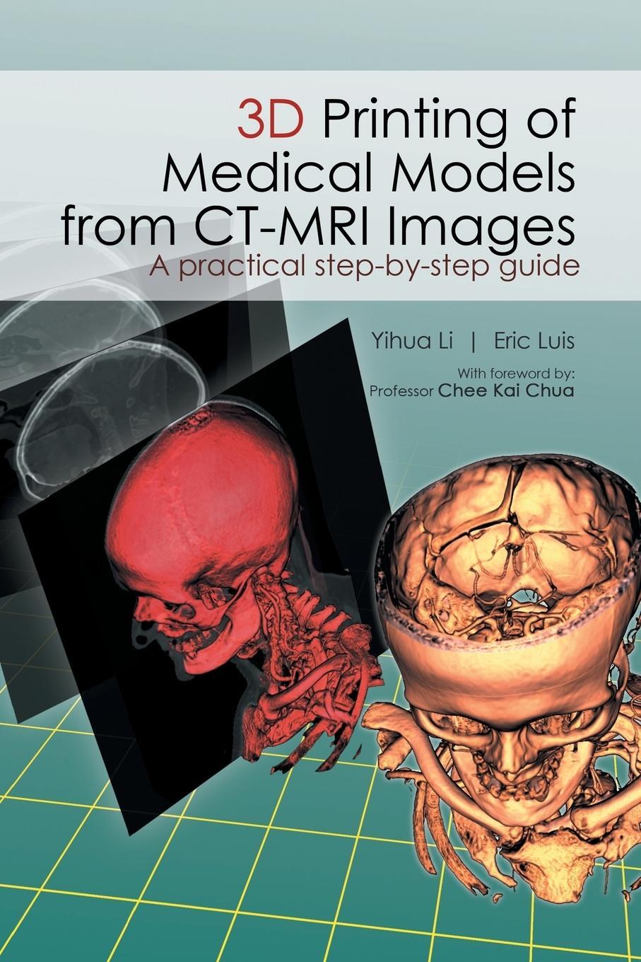 Cover: 9781482879407 | 3D Printing of Medical Models from CT-MRI Images | Li Yihua (u. a.)