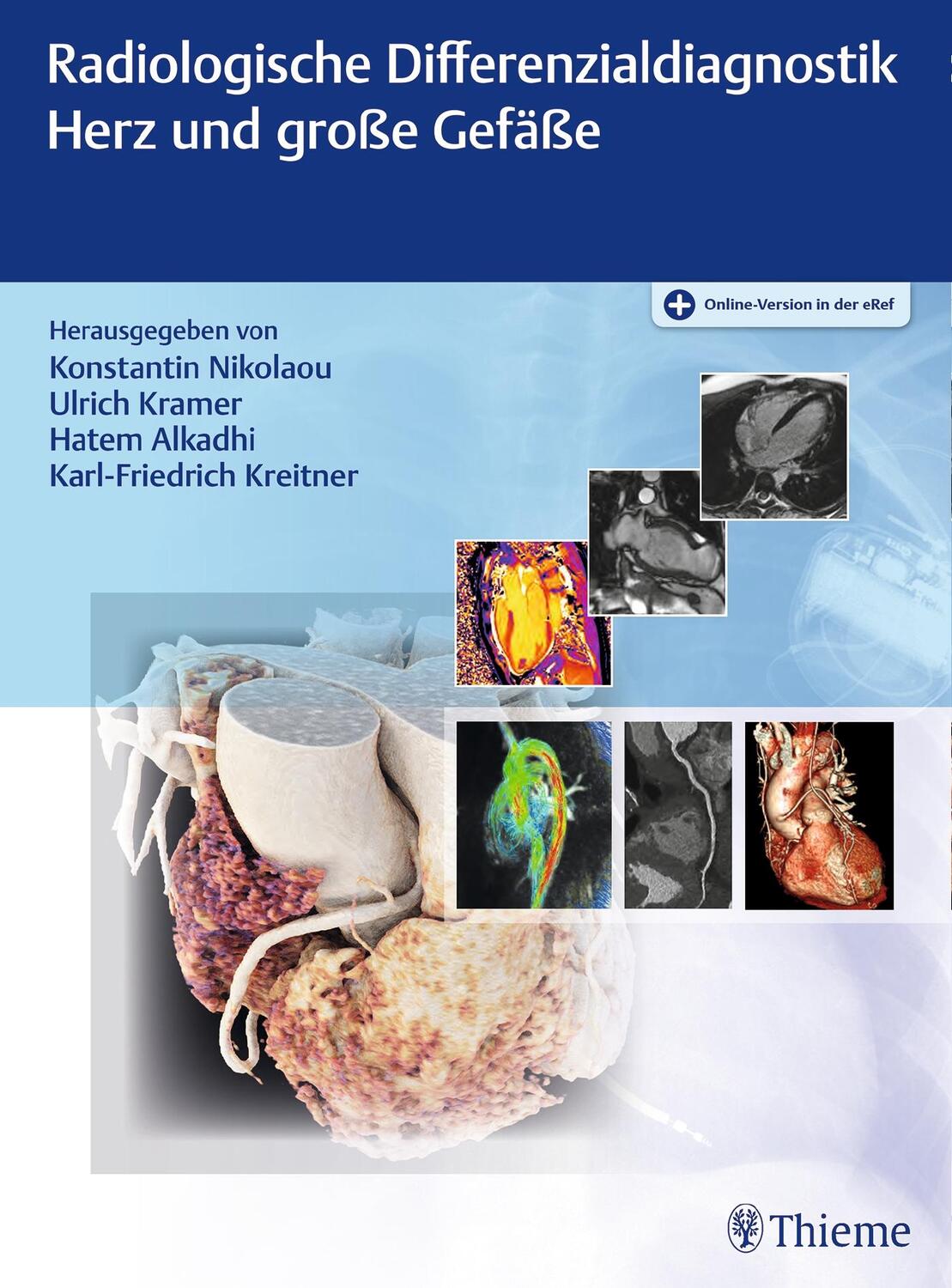 Cover: 9783132051515 | Radiologische Differenzialdiagnostik Herz und große Gefäße | Bundle