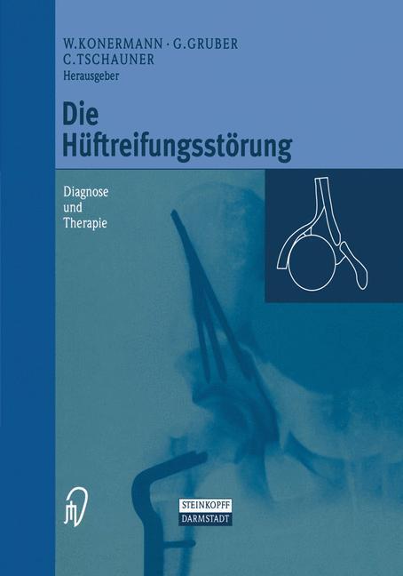 Cover: 9783798511323 | Die Hüftreifungsstörung | Diagnose und Therapie | Konermann (u. a.)