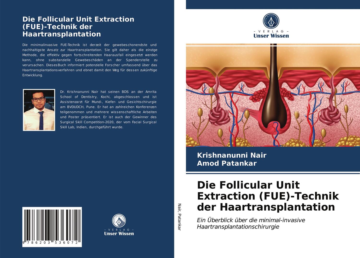 Cover: 9786203536072 | Die Follicular Unit Extraction (FUE)-Technik der Haartransplantation