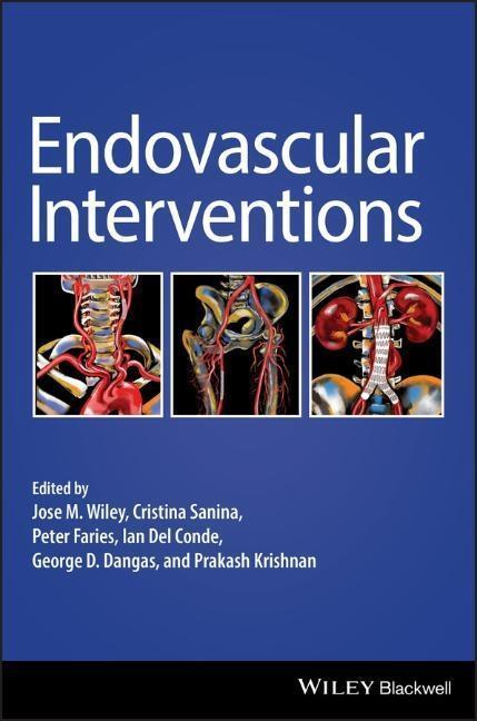 Cover: 9781119283492 | Endovascular Interventions | Jose M Wiley (u. a.) | Buch | 328 S.