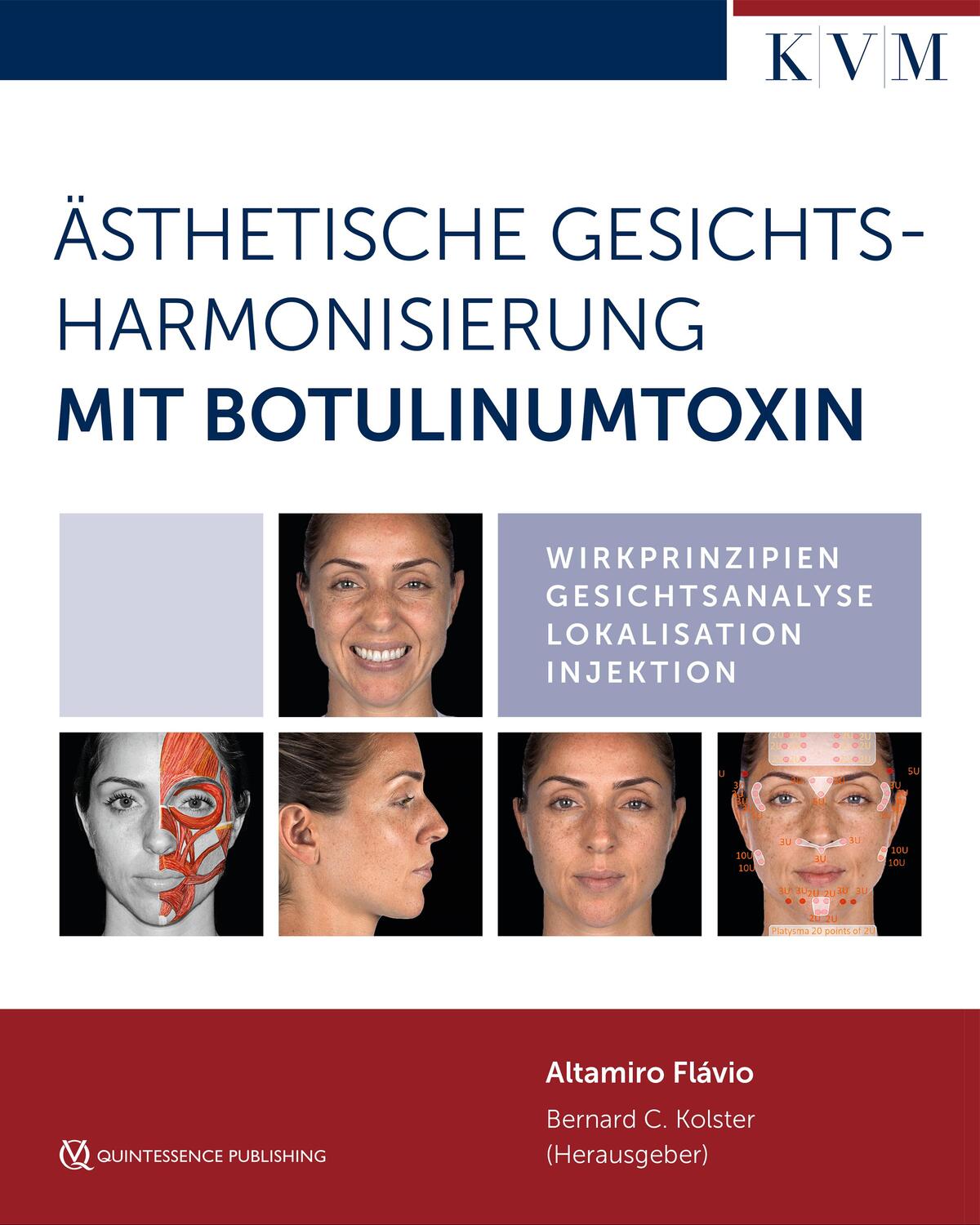 Cover: 9783868674798 | Ästhetische Gesichtsharmonisierung mit Botulinumtoxin | Flávio | Buch