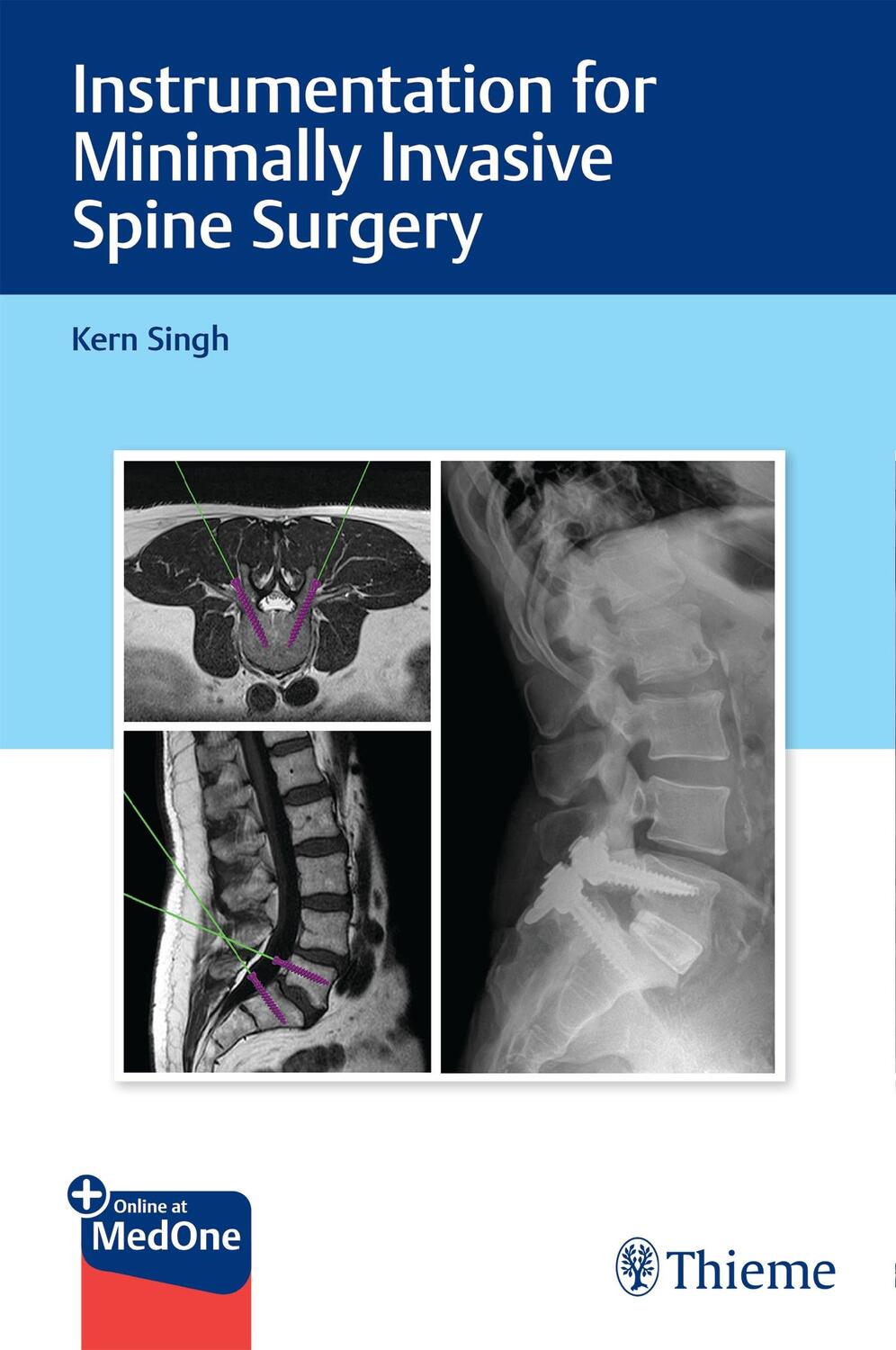 Cover: 9781626232020 | Instrumentation for Minimally Invasive Spine Surgery | Kern Singh