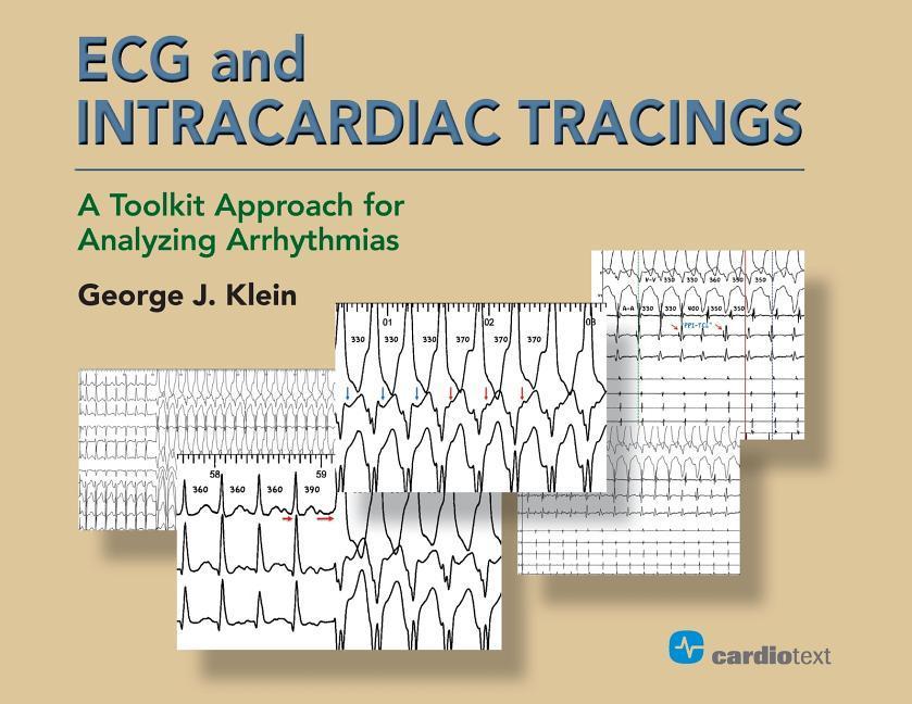 Cover: 9781942909255 | ECG &amp; INTRACARDIAC TRACINGS | George J. Klein | Taschenbuch | Englisch