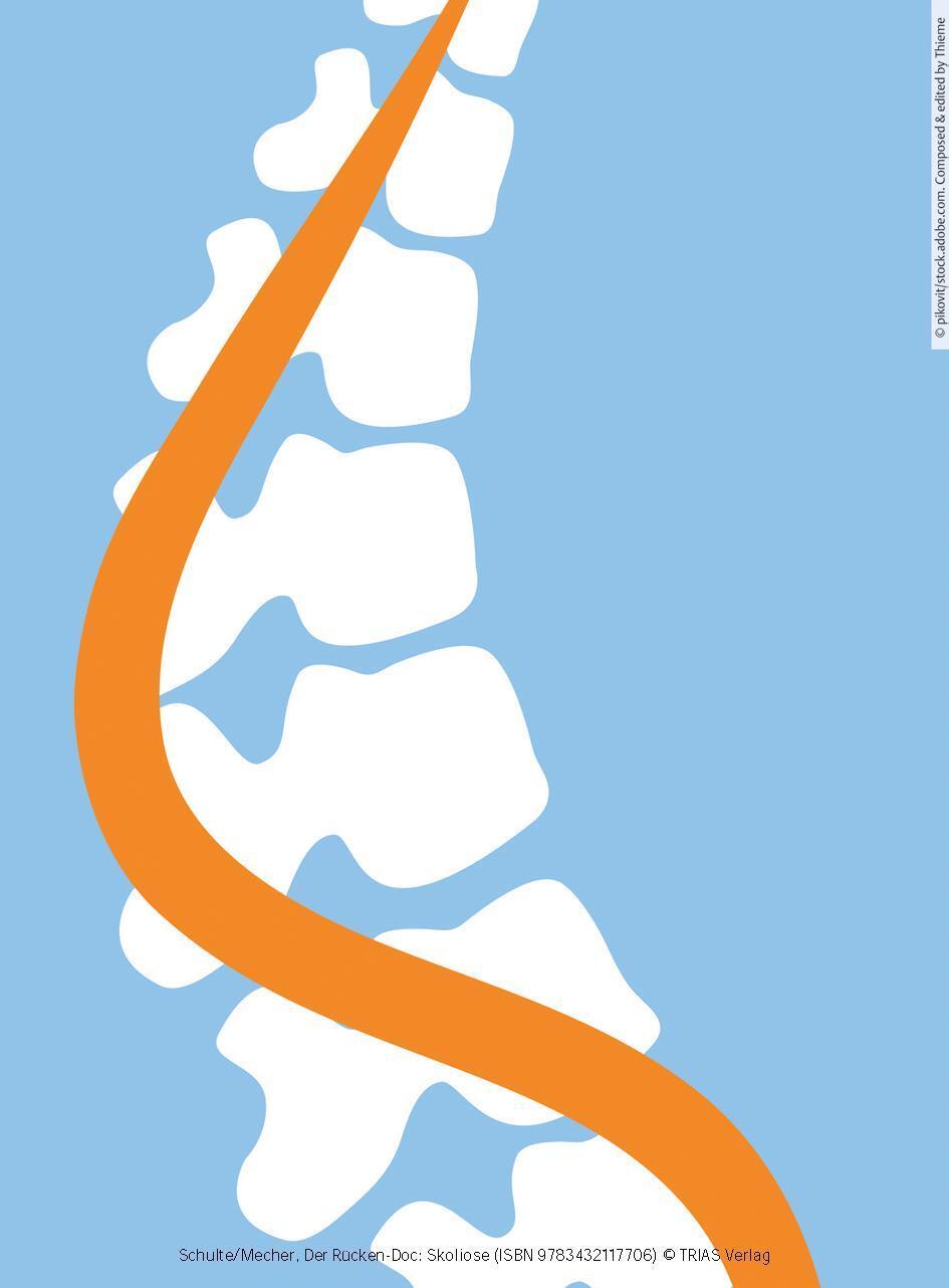 Bild: 9783432117706 | Der Rücken-Doc: Skoliose | Tobias L. Schulte (u. a.) | Taschenbuch
