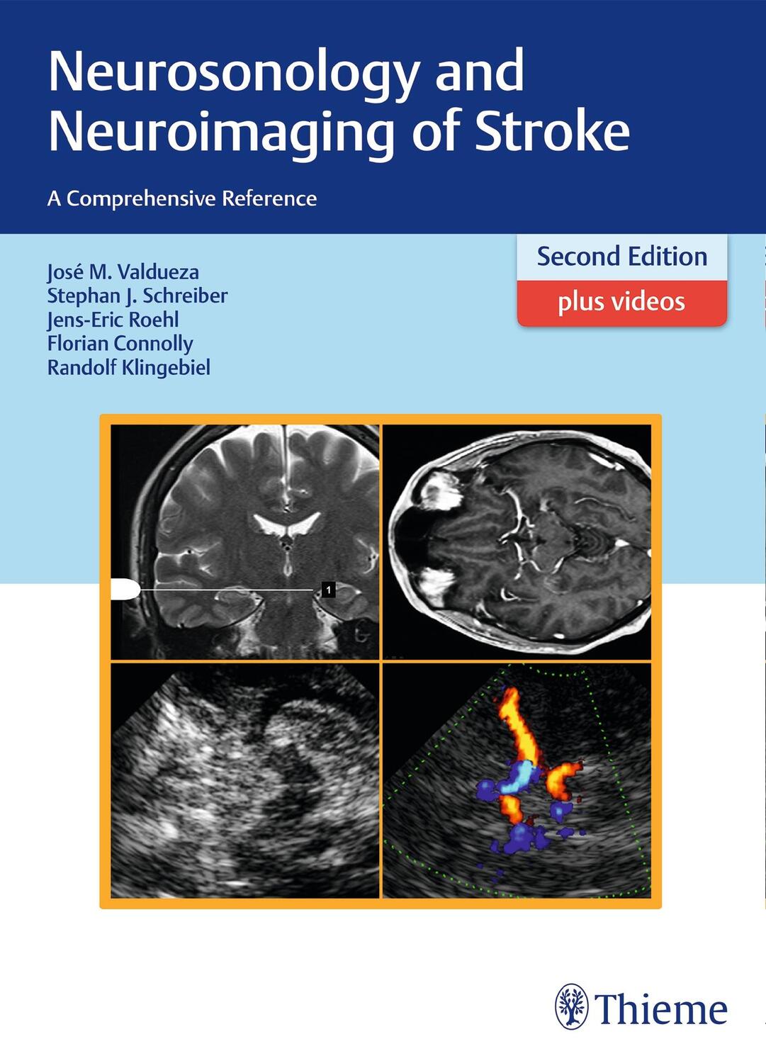 Cover: 9783131418722 | Neurosonology and Neuroimaging of Stroke | A Comprehensive Reference
